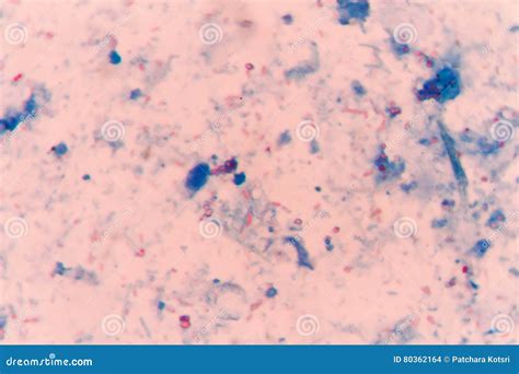  Microsporidia: Um Parasita Microscopico Que Faz Você Pensar Duas Vezes Antes de Comer Cogumelos Silvestres!