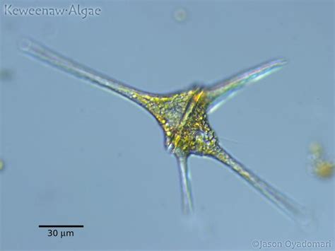  Peridinium: Descubra o mistério das algas dinoflageladas que brilham à noite!